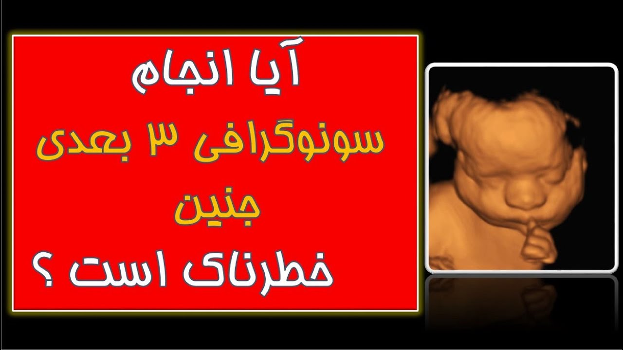 آیا آنجام سونوگرافی سه بعدی جنین خطرناک است ؟