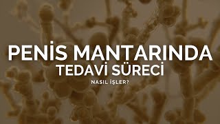Penis Mantarında Tedavi Süreci Nasıl İşler? - Prof. Dr. Ömer Faruk ...