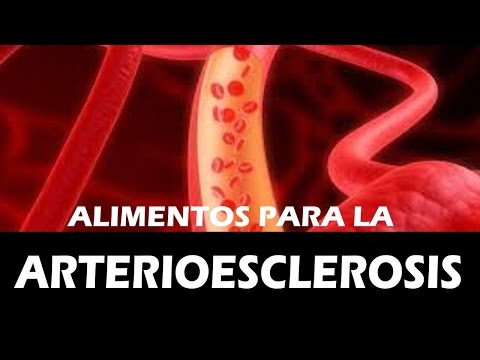Vídeo: 4 Alimentos Esenciales Para La Aterosclerosis