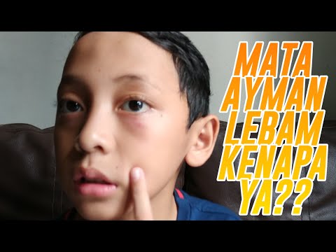 Video: Lebam Biasa