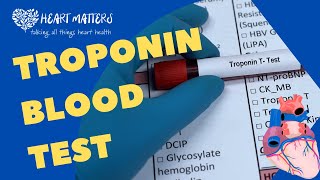 All About the Troponin Blood Test