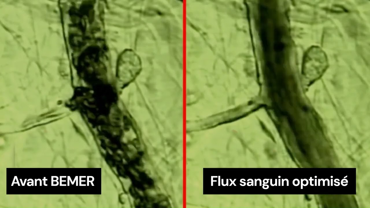 L’impact de BEMER sur vos microvaisseaux