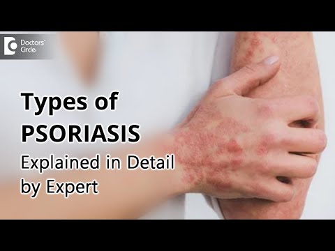 Types Of Psoriasis | Explained in Detail by EXPERT - Dr. Chaithanya K S | Doctors&rsquo; Circle