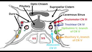 Cavernous Sinus Anatomy & Cavernous Sinus Syndrome