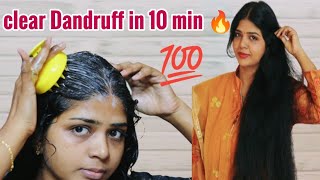 clear dandruff in just 10 min 🔥/பொடுகு தொல்லை 10 நிமிடத்தில் சரி செய்யலாம்/ scalp massager review