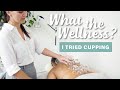 Cupping Therapy Treatment  | What the Wellness | Well+Good