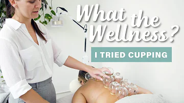 What does cupping do for the body?