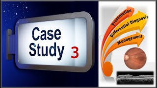 Case Study 3 | AP's Case Study Pearls