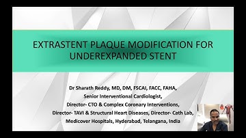 Extrastent Plaque Modification With Knuckle Wire By Dr. Sharath Reddy