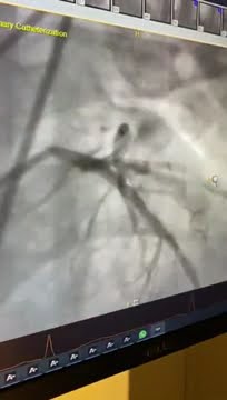 KALP HASTALIĞI YAŞA BAĞLI MIDIR?