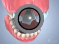 Facettes dentaires en cramiqueflv