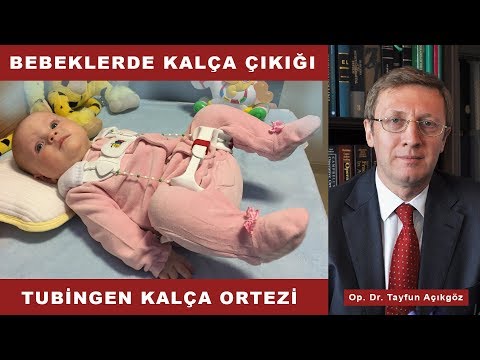 Tubingen Kalça Ortezi - Op. Dr. Tayfun Açıkgöz