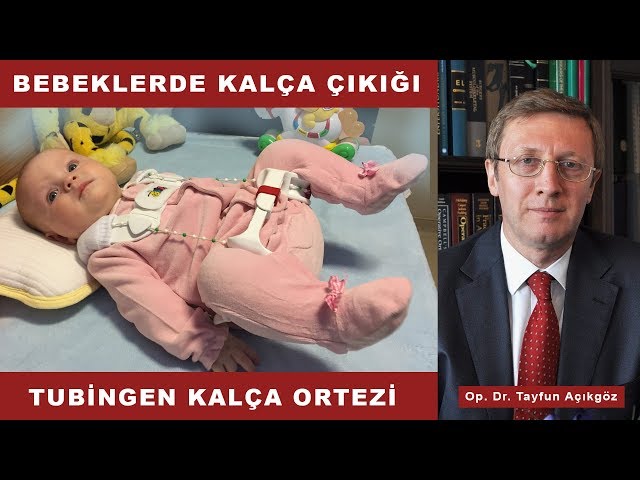 Tubingen Kalça Ortezi - Op. Dr. Tayfun Açıkgöz