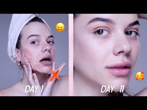 Видео: Как получить красивую кожу: 15 шагов (с изображениями)