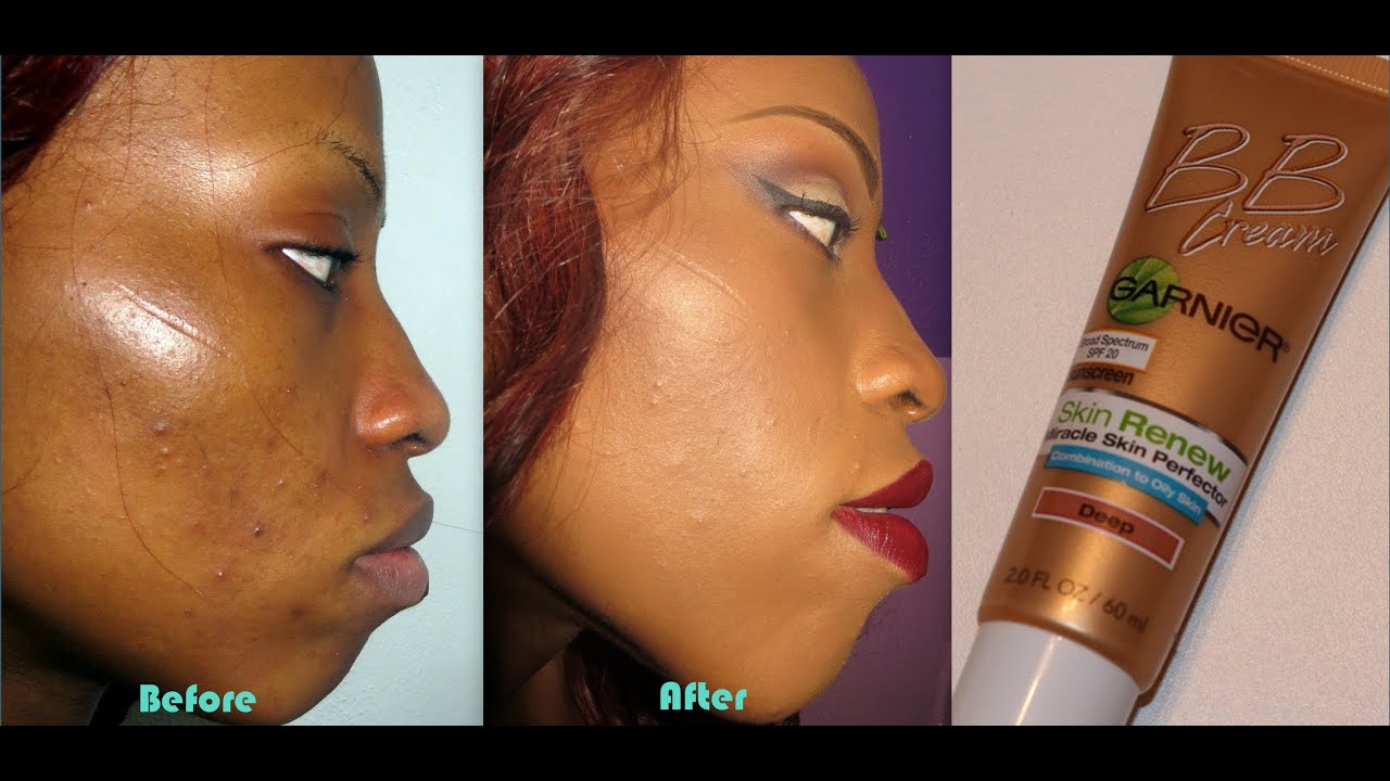 New! Garnier Skin Renew BB Cream For Oily/Combo Skin: Demo & Review -  YouTube