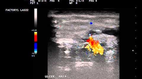 AVF Chaotic Flow in Color