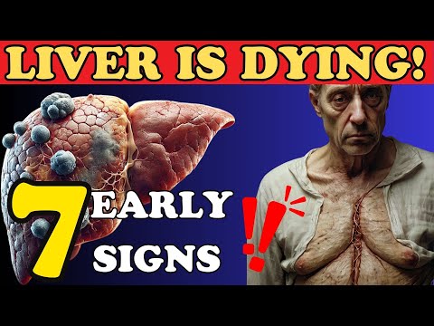 Liver Is Dying!