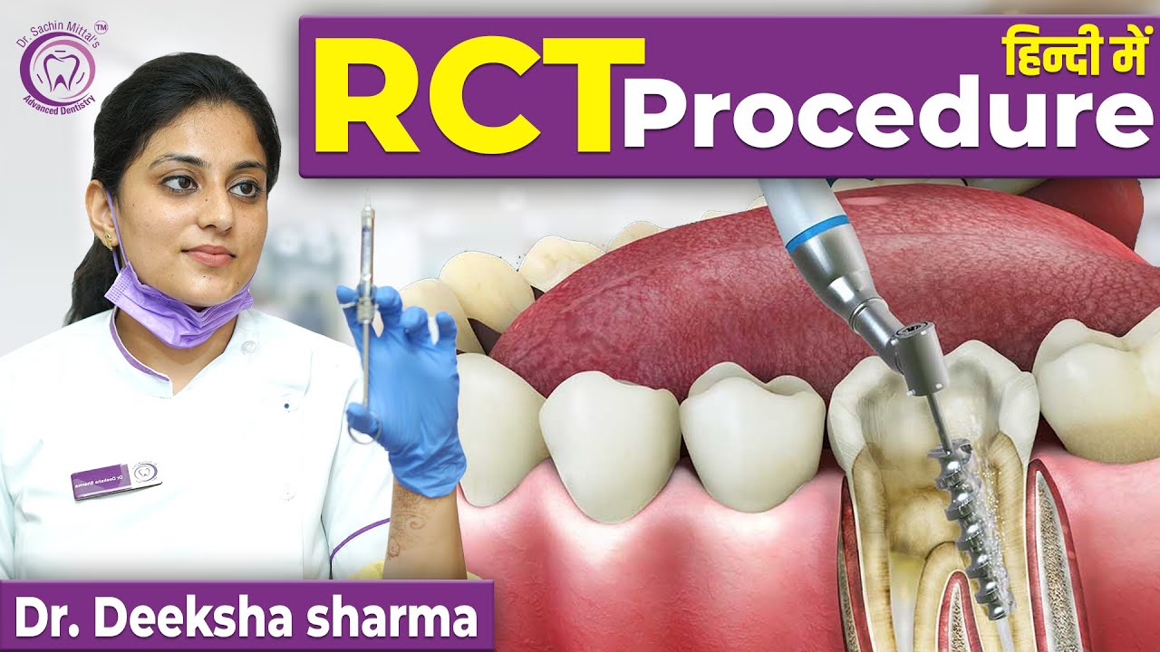 Roots Format Rct Root Canal Treatment RCT step by step Procedure | RCT करवाने से पहले ...