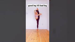 Good Leg VS Bad Leg Flexibility #shorts