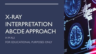 AF SOMALI CHEST X-RAY CASHARKA 3 aad screenshot 4