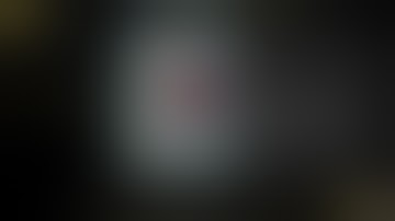 Laparoscopic, transgastric resection of gastric cardia mass