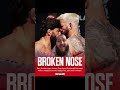 Dan Hooker reveals Arman Tsarukyan headbutt broke his nose #mma #ufc #combatsports #mmanews