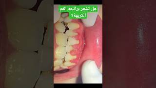 اسألة لا تعلم اجابتها في عيادة الاسنان|| دكتور عبدالله سلطان الهنداوي
