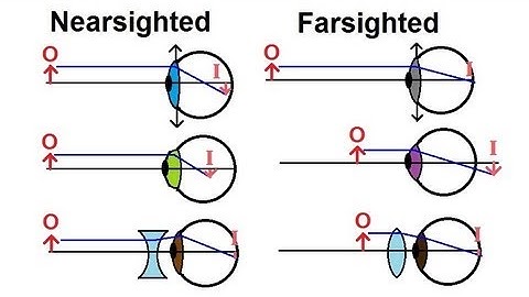 Physics - Optics: Vision Correction (1 of 5) Introduction