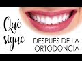 MEJORA TU SONRISA AÚN MÁS  | ¿QUÉ SIGUE DESPUÉS DE LA ORTODONCIA?