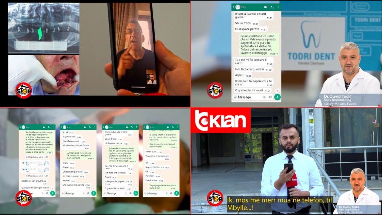 Stop/ “O fytyrë m*t, pe**rast”, Dentisti i prish dhëmbët e kërcënon italianin - 12 Shtator 2023