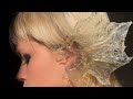 ear health