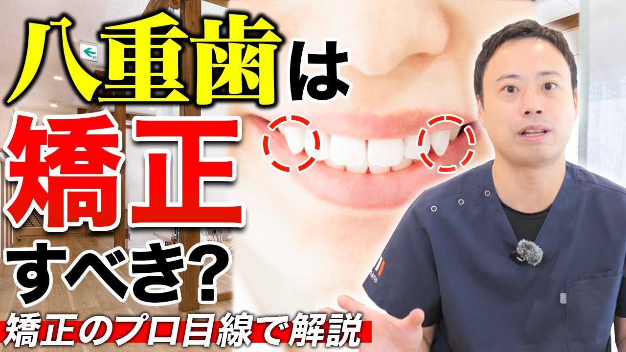 八重歯は矯正すべき？歯列矯正のプロが本音で解説