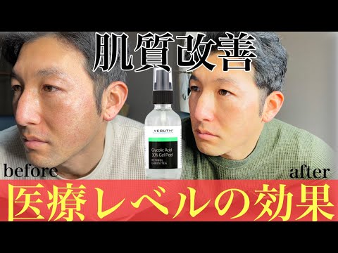 [美容]毛穴の開き、肌質改善！医療レベルのアンチエイジ効果を発揮したジェルとは？？