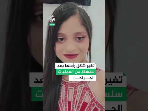 الطفلة الفلسطينية مريم إبراهيم كيف غي ر القصف الإسرائيلي ملامح وجهها