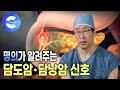 혹시 소화불량이라면? 몰라서 더 치명적인 암 | 조기 발견이 쉽지 않고 전이가 빨라 위험한 담도암, 담낭암 | 명의