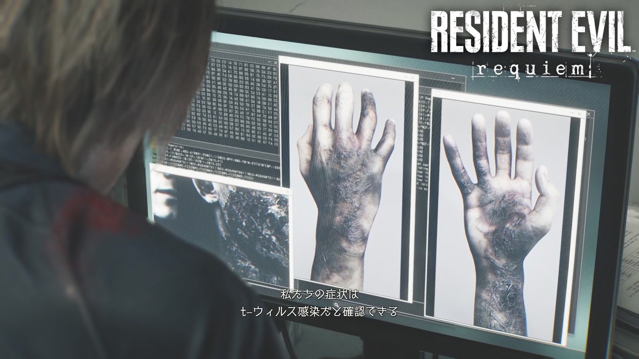 バイオ9】レオン・・・、t-ウイルスに感染してたのか・・・。 #5