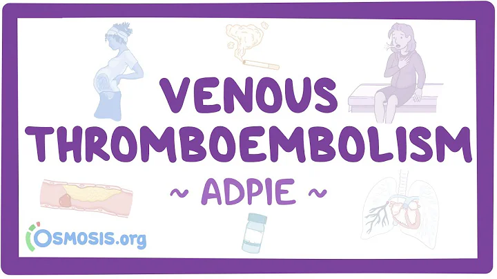 Venous thromboembolism (VTE): Nursing Process (ADPIE)