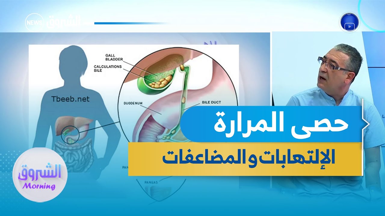 حصى المرارة.. الإلتهابات و مضاعفات ما بعد العملية بالمنظار