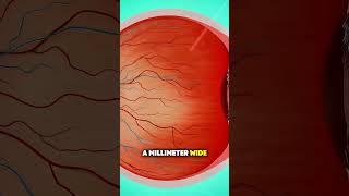 How Vitrectomy Eye Surgery is Performed | 3D Medical Animation #Shorts