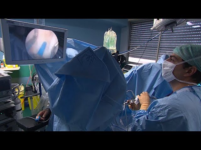 Prostatectomia robotica - Chirurgie robotica - greenhouseresidence.ro