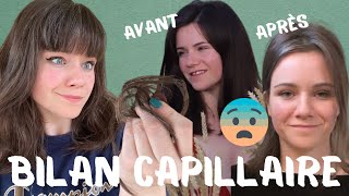 FRANGE ET ALOPECIE PASSAGERE | BILAN CAPILLAIRE