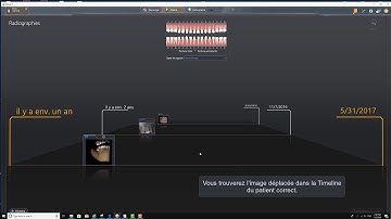 FR-sidexis-4-deplacer-image.mp4