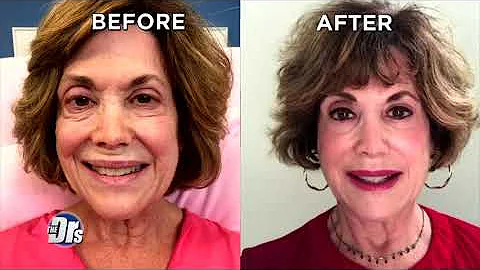 Did 20-Minute Procedure Erase 20 Years from Womans...