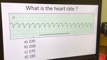 Telemetry Analysis: Video 1: Determining Regularity and Heart Rate