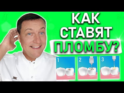 Как делают пломбу на зуб? Все этапы ПРОСТЫМИ словами. Подробное описание установки пломбы на зуб.