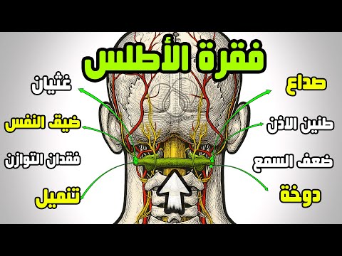 الأطلس محور الأعراض العصبية الغامضة صداع تنميل دوخة زغللة طنين غثيان التوازن إغماء مفاجئ