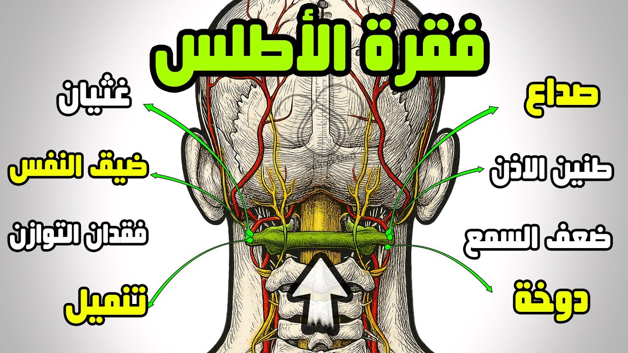 الأطلس | محور الأعراض العصبية الغامضة | صداع, تنميل، دوخة, زغللة، طنين، غثيان, التوازن, إغماء مفاجئ