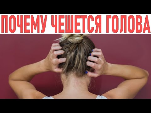 Видео: Как перестать чесать голову: 11 шагов (с картинками)