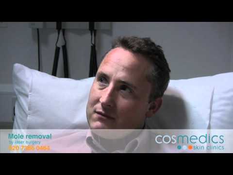 Mole Removal Costs