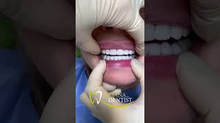 Вражаюча робота лікаря Ковальської Юлії ✅#dentist #dentalclinic #dnipro #ukraine
